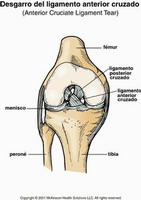 apitoxina ligamento cruzado anterior